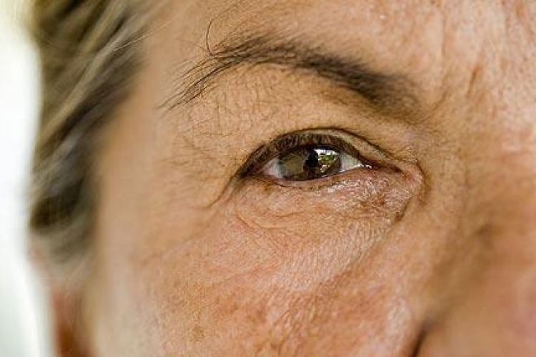 A szem sejtjeinek változása segíthet felismerni az Alzheimer-kórt